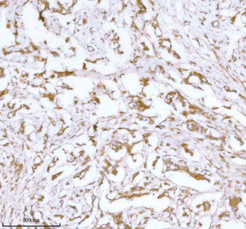 IHC analysis of STC2 using anti-STC2 antibody. STC2 was detected in a paraffin-embedded section of h