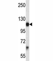 Pdgfra antibody western blot analysis in mouse brain tissue lysate. Predicted molecular weight: 120-