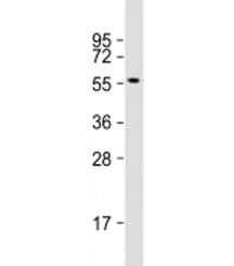 Western blot testing of human MOLT4 cell lysate with ETS1 antibody at 1:500. Predicted molecular wei
