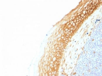 Beta Catenin Antibody