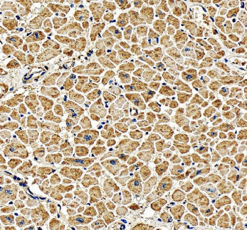 PGAM2 Antibody / Phosphoglycerate mutase 2, 100ug