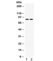 Western blot testing of 1) human HeLa and 2) mouse NIH3T3 cell lysate with Phospholipase A2 antibody