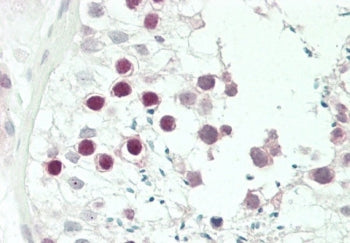 IHC testing of FFPE human testis tissue with JHDM1D antibody. HIER: steam section in pH6 citrate buf