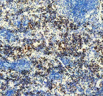Immunohistochemical staining of Ki67/MKI67 using anti-Ki-67 antibody. Ki67/MKI67 was detected in a p