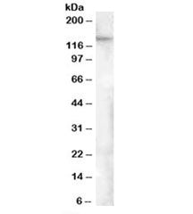 Western blot testing of human adipose lysate with FAM62A antibody at 0.5ug/ml. Predicted molecular w