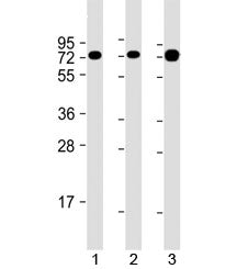Western blot testing of human 1) Jurkat, 2) Ramos and 3) HT-1080 cell lysate with GARS antibody at 1