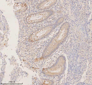 Immunohistochemical staining of RIGI using anti-RIGI antibody. RIGI was detected in a paraffin-embed