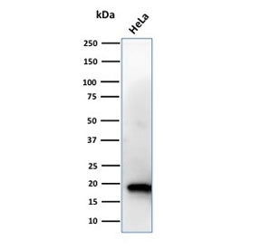 Western blot testing of human HeLa cell lysate with NME1 antibody. Predicted molecular weight ~17 kD