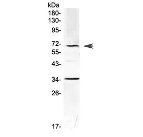 Western blot testing of mouse HEPA1-6 cell lysate with Alpha 1 Fetoprotein antibody at 0.5ug/ml. Pre