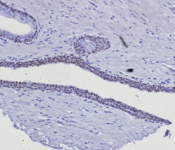 GATA3 Antibody