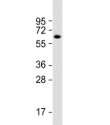 Western blot testing of mouse brain lysate with ZNF238 antibody at 1:2000. Predicted molecular weigh