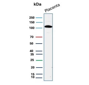Western blot testing of human placental tissue lysate with recombinant E-Cadherin antibody. Expected