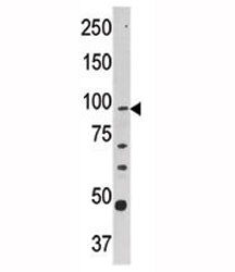 CPT1A Antibody