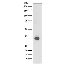 CD20 Antibody
