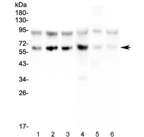 PD1 Antibody