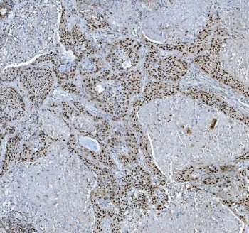 TRMT6 Antibody