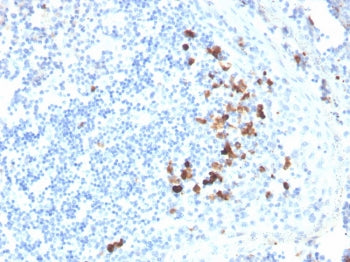 IHC staining of FFPE human tonsil with Anti-IgA antibody. HIER: boil tissue sections in pH 9 10mM Tr