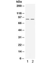 Western blot testing of 1) rat testis and 2) human K562 lysate with UHRF2 antibody. Expected/observe