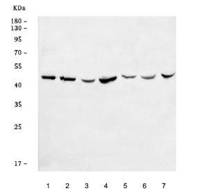 Western blot testing of 1) human 293T, 2) human HeLa, 3) human U-87 MG, 4) human HaCaT, 5) rat testi