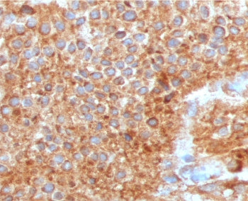 Uroplakin 1A Antibody / UPK1A