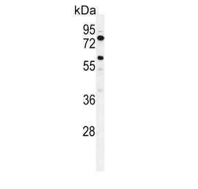 Western blot testing of human K562 cell lysate with ACSBG2 antibody. Expected molecular weight: 75-8