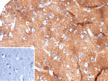 IHC staining of FFPE human brain tissue with HK1 antibody (clone HK1/9508). Inset: PBS used in place
