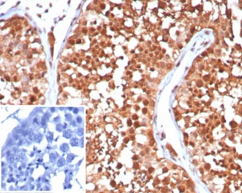 HSP70 Antibody / HSPA1A