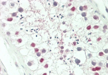 IHC testing of FFPE human testis tissue with HOXA3 antibody. HIER: steam section in pH6 citrate buff