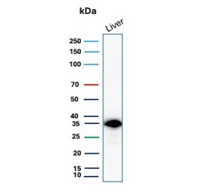 Western blot testing of human liver lysate with SULT1E1 antibody (clone CPTC-SULT1E1-1). Expected mo