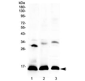 HBD Antibody / Hemoglobin subunit delta