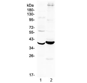 Western blot testing of 1) mouse kidney and 2) human MCF7 cell lysate with Follistatin antibody at 0