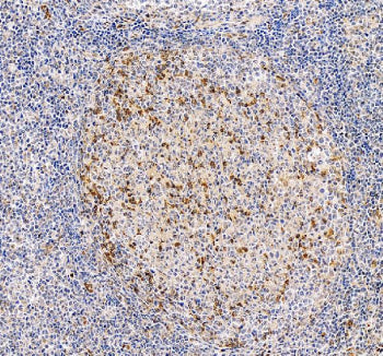IHC staining of FFPE human tonsil tissue with PD1 antibody. HIER: boil tissue sections in pH8 EDTA f