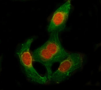SESN1 Antibody / Sestrin 1 / SEST1 / PA26