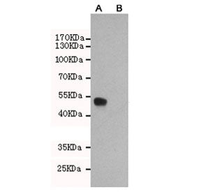 Western blot testing of A) CHO-K1 cells transfected with a partial ERa protein and B) untransfected