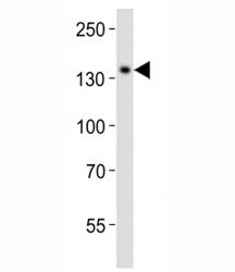 SALL4 Antibody