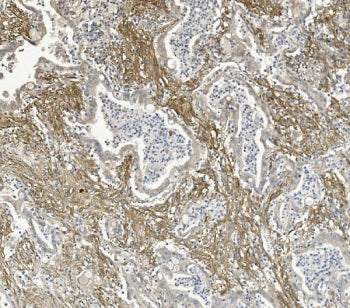 ITGB5 Antibody / Integrin beta 5