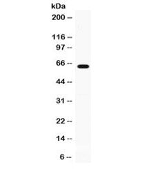 GPI Antibody / Glucose-6-phosphate isomerase