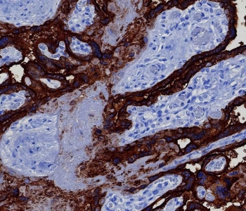IHC staining of FFPE human placental tissue with recombinant PLAP antibody (clone ALPP/8112R). HIER: