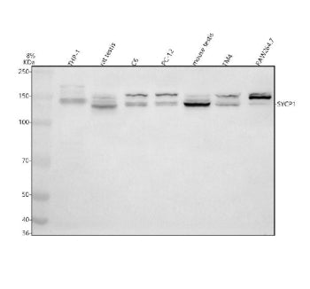 Western blot analysis of SYCP1 using anti-SYCP1 antibody. Electrophoresis was performed on a 8% SDS-