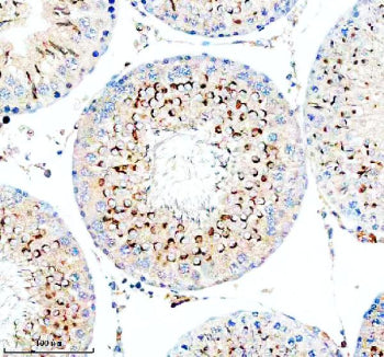 Immunohistochemical staining of TESMIN using anti-TESMIN antibody. TESMIN was detected in a paraffin