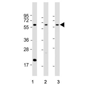 Western blot testing of 1) human PANC-1, 2) mouse cerebellum and 3) rat cerebellum tissue lysate wit