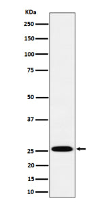 Western blot analysis of INMT expression in human A549 cell lysate using INMT antibody. Predicted mo