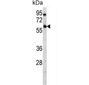 USP14 Antibody