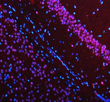 Immunofluorescent staining of MECP2 using anti-MECP2 antibody (red). MECP2 was detected in a paraffi