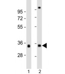 Western blot testing of 1) human skeletal muscle and 2) human heart lysate with TPM3 antibody at 1:2