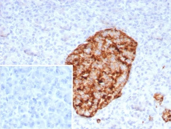 IHC staining of FFPE human pancreas tissue with recombinant GAD2 antibody (clone rGAD2/9382). Inset:
