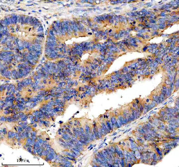 Immunohistochemical staining of EIF3H using anti-EIF3H antibody. EIF3H was detected in a paraffin-em