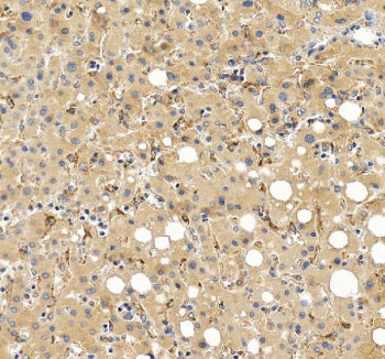 Immunohistochemical staining of FGL1 using anti-FGL1 antibody. FGL1 was detected in a paraffin-embed