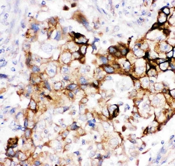 Heme Oxygenase 2 Antibody