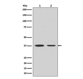 Arginase 1 Antibody